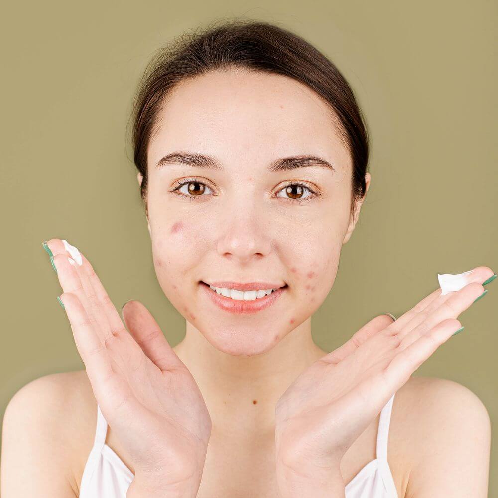 The Best Primers To Disguise Your Acne Scars Get A Flawless Finish