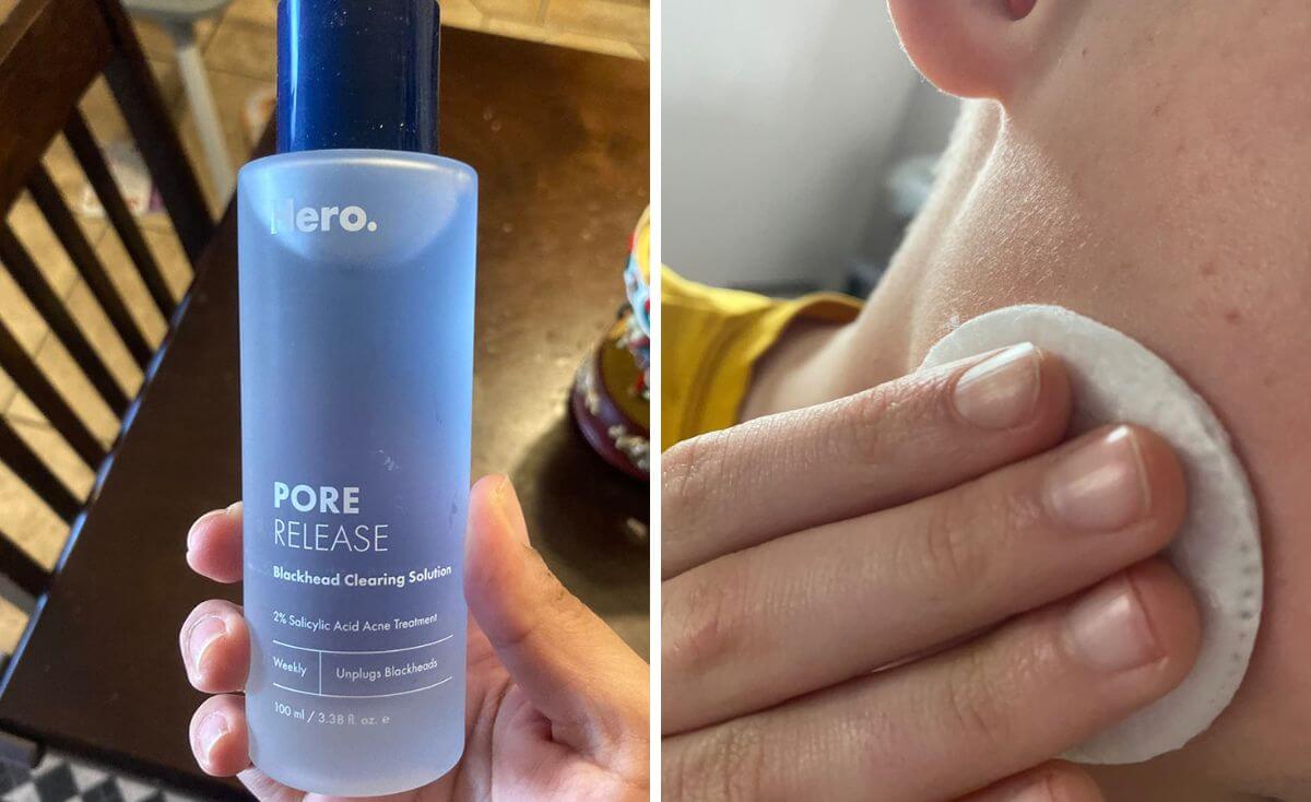 Unplug Your Gunky Pores With Hero Cosmetics Pore Release 5737