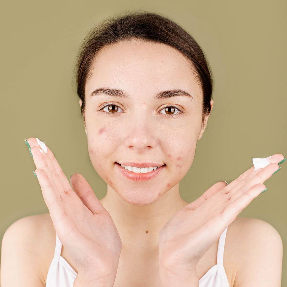 The Best Primers to Disguise Your Acne Scars - Get a Flawless Finish!