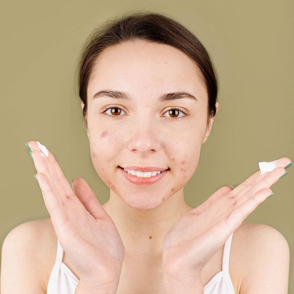 The Best Primers to Disguise Your Acne Scars - Get a Flawless Finish!