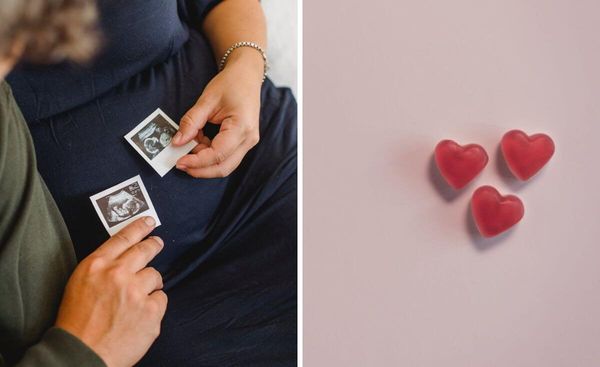 Get All The Nutrients You Need With These Top Rated Prenatal Gummies